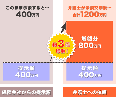 ケース2：30代男性　後遺障害等級11級の例
